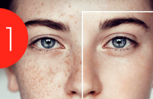 Etkili Çil Leke Benek Kremi