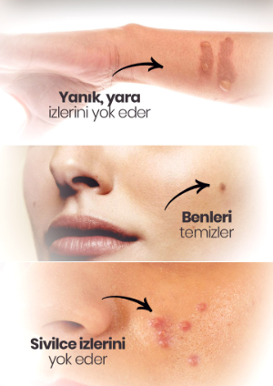 Etkili Çil Leke Benek Kremi